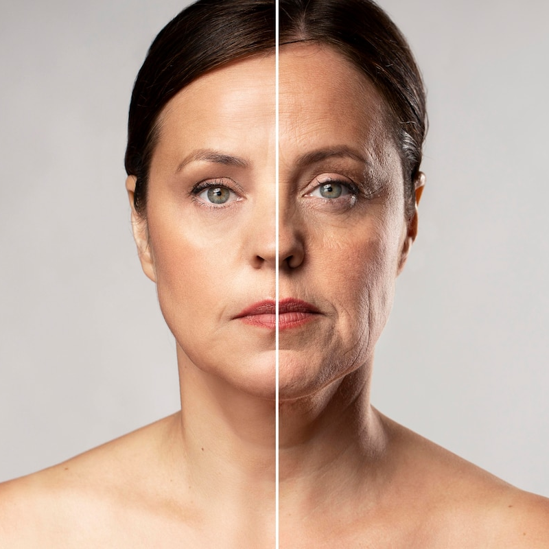 Rugas e Envelhecimento